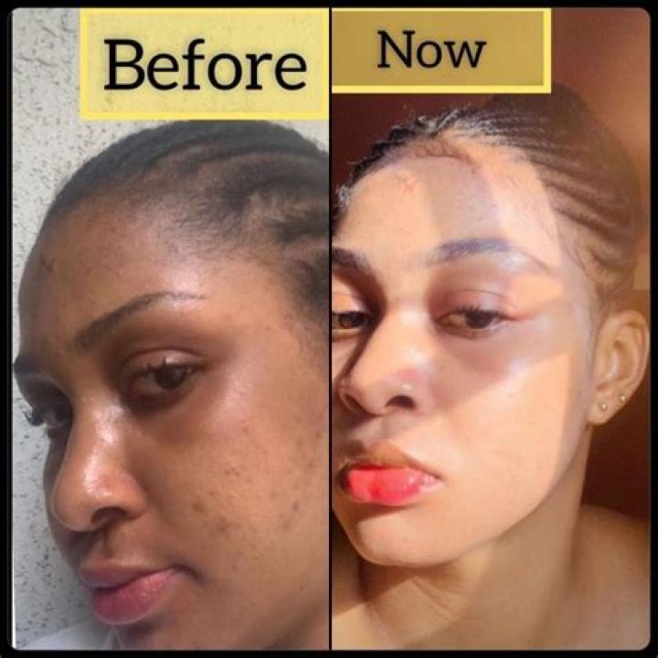 Can soap lighten skin?